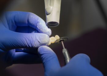 implantacija