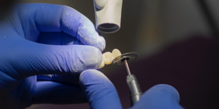 implantacija